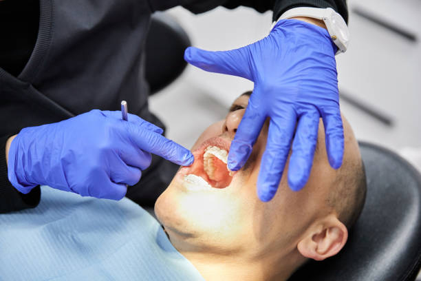 Best Teeth Whitening  in Mansfield, AR